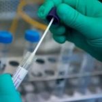 تسجيل إصابة جديدة بالفيروس في إربد