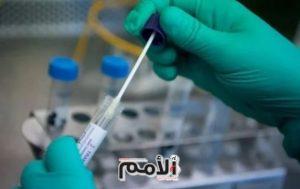 تسجيل إصابة جديدة بالفيروس في إربد